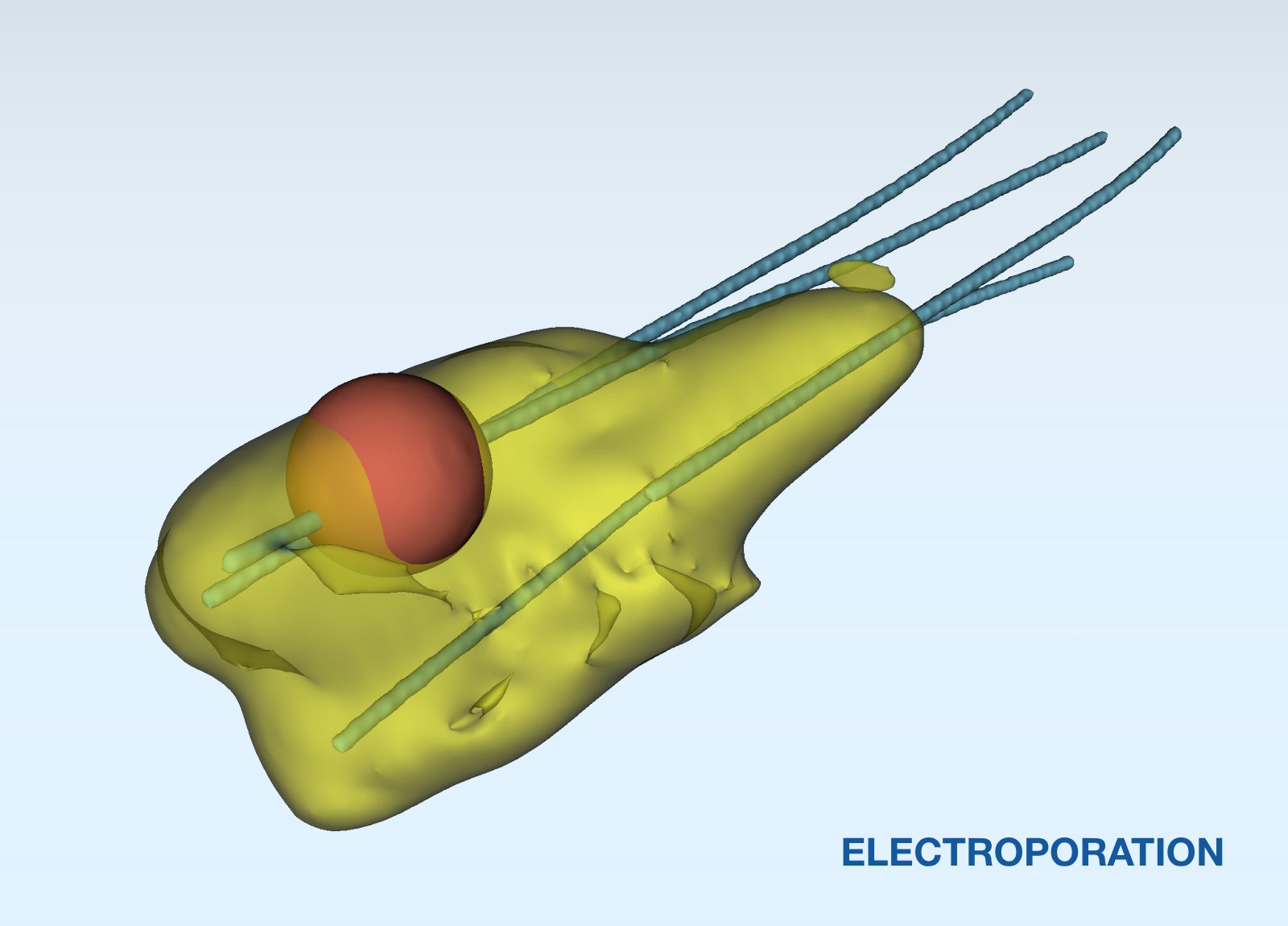 EP ablation coverage