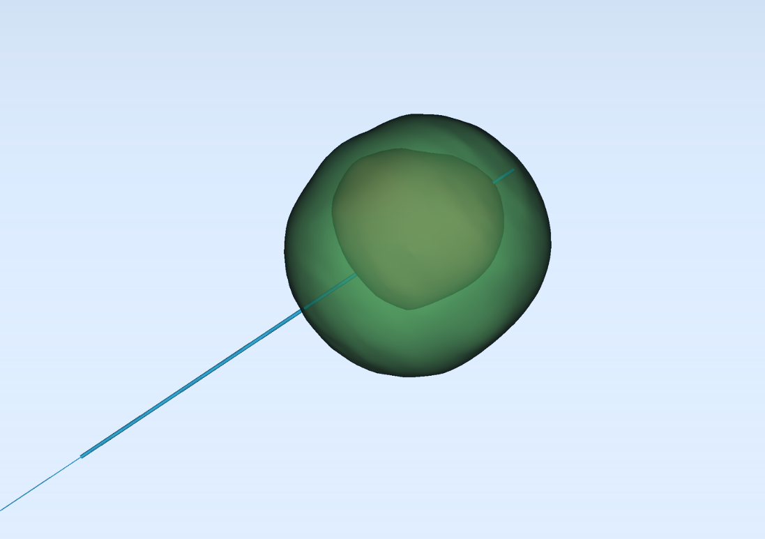 Theoretical ablation zone — generic, not patient-specific