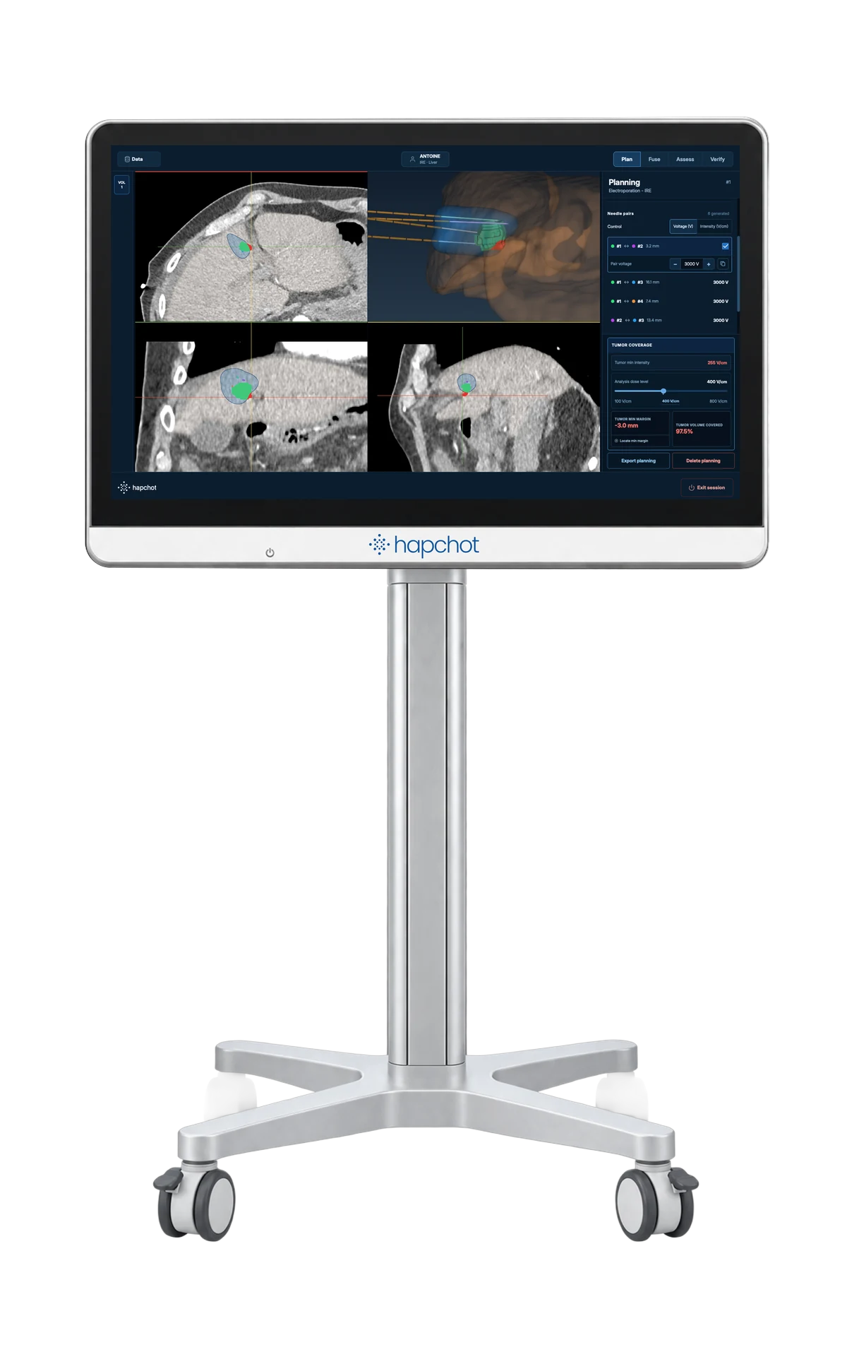 The hapchot device — a mobile cart with the planning screen