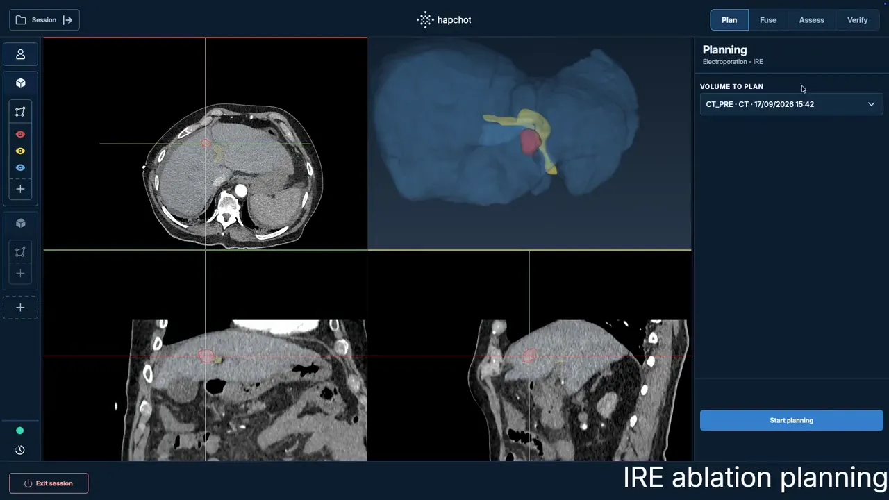 hapchot planning software: IRE then microwave planning walkthrough